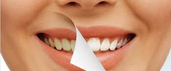 Snowhite Teeth Whitening – كيف تستعمل – كريم – طلب تبييض الأسنان
